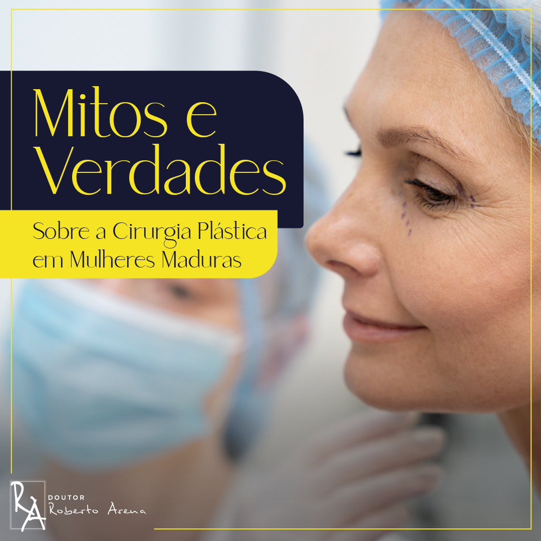 CAPA SITE   Mitoseverdade