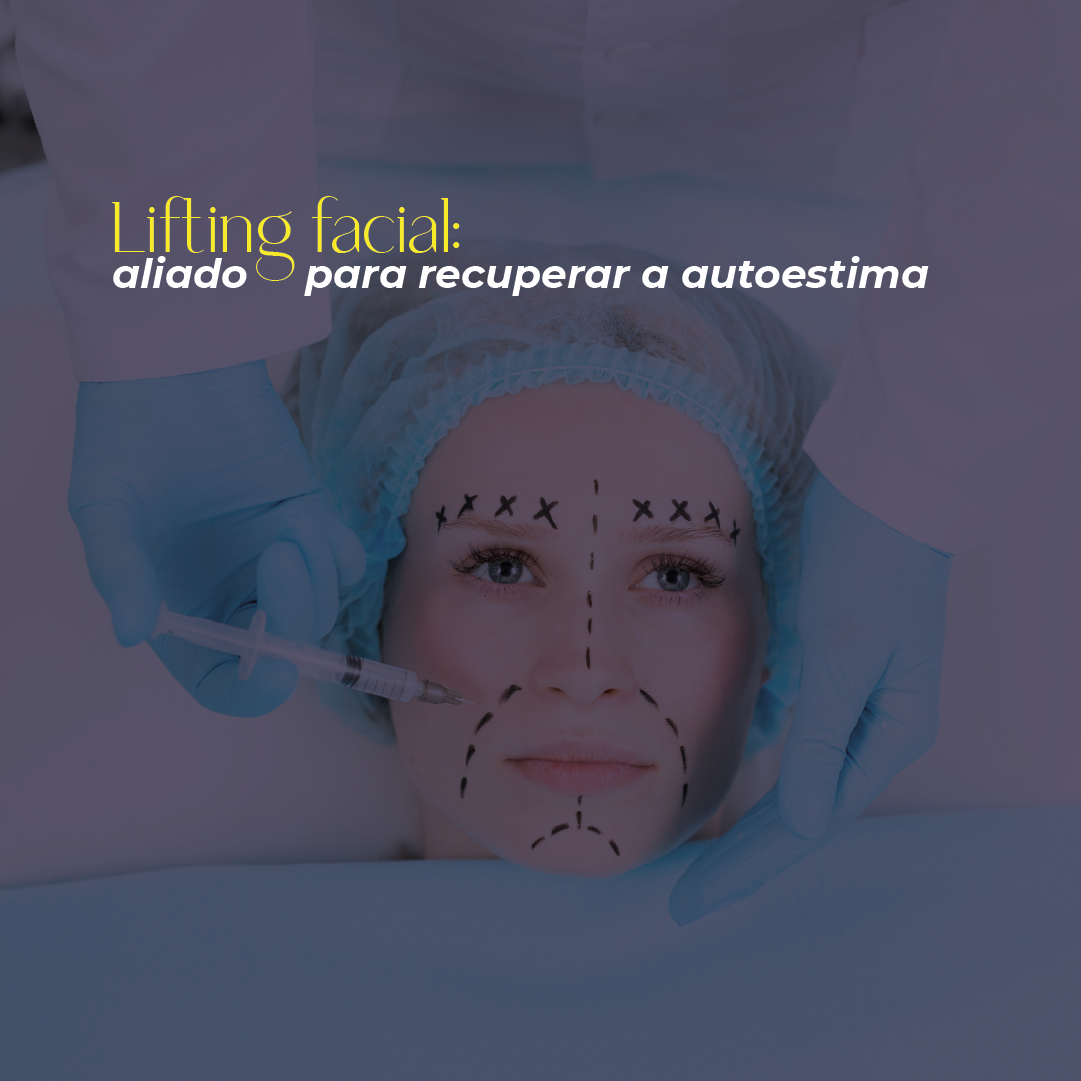 Site Google Trends 1 Site Google Trends 1